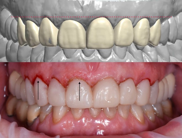 come capire se migliorare il sorriso