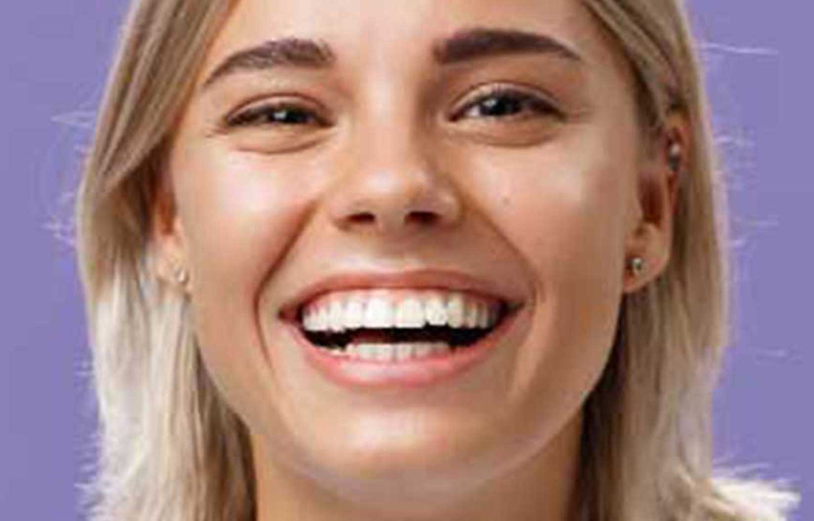 Sorriso a bocca aperta