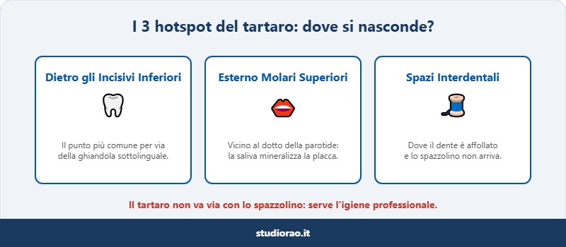 dove si forma di più il tartaro: incisivi inferiori, molari superiori e spazi interdentali